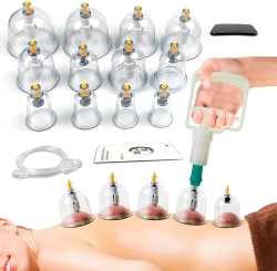 cupping therapy