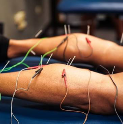 American electro Dry needling therapy